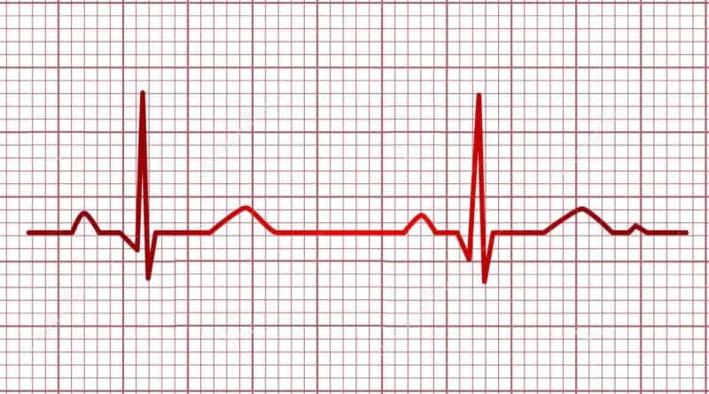 electrocardiograma hermosillo electrocardiograma hermosillo - Salud Ocupacional en México