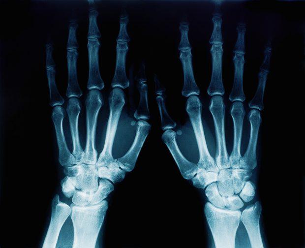 rayos x Salud Ocupacional para Empresas - Servicio de rayos x